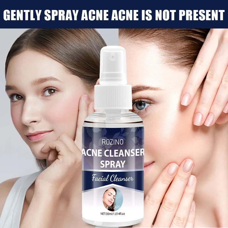 Acne Repair Spray Rozino Soothing Facial Mist for Redness and Clear Skin 30ml