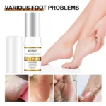 Rozino Retinol Foot Repair Stick Cracked Heel Balm Spu778933106234 2