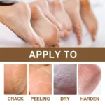 Rozino Retinol Foot Repair Stick Cracked Heel Balm Spu778933106234 4