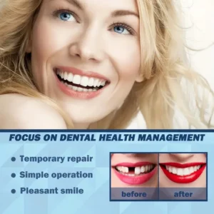 Tooth Repair Kit ROZINO Moldable Thermal Forming False Teeth for Missing Gaps 30g