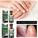 Nail Fungus Treatment EELHOE Repair Liquid for Damaged, Thick, and Brittle Nails
