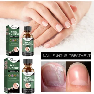 Nail Fungus Treatment EELHOE Repair Liquid for Damaged, Thick, and Brittle Nails