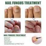 Eelhoe Nail Fungus Treatment Repair Liquid Roz P8xveqt2 2