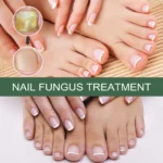 Eelhoe Nail Fungus Treatment Repair Liquid Roz P8xveqt2 3
