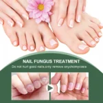 Eelhoe Nail Fungus Treatment Repair Liquid Roz P8xveqt2 4