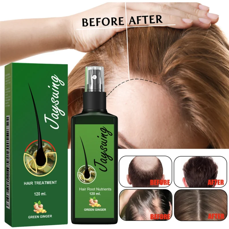 Hair Growth Spray Ginger Scalp Treatment for Thinning Hair and Root Repair