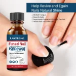 Lanthome Fungal Nail Renewal Serum Repair Roz Tdhgtywq 2