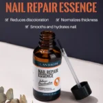 Nail Repair Essence - LANTHOME Fungal Nail Treatment Serum for Discolored & Thick Nails - Moisturizing Cuticle Care (30ml)