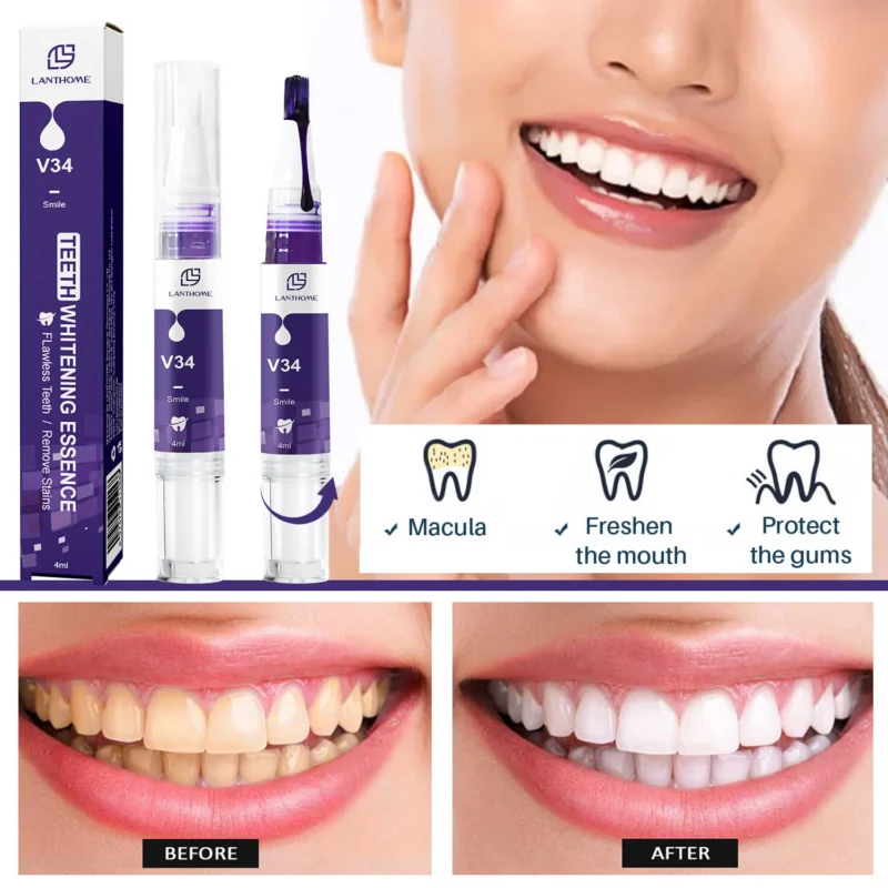 Teeth Whitening Pen V34 Color Corrector Essence for Stain Removal 4ml