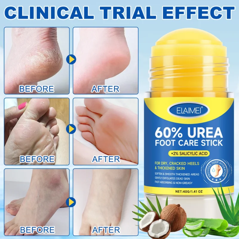 Urea Foot Care Stick Cracked Heel Balm Elaimei Roz Evq33ta3 2